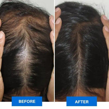 Smart Scalp Massager™ Intelligent Electric Head Massager